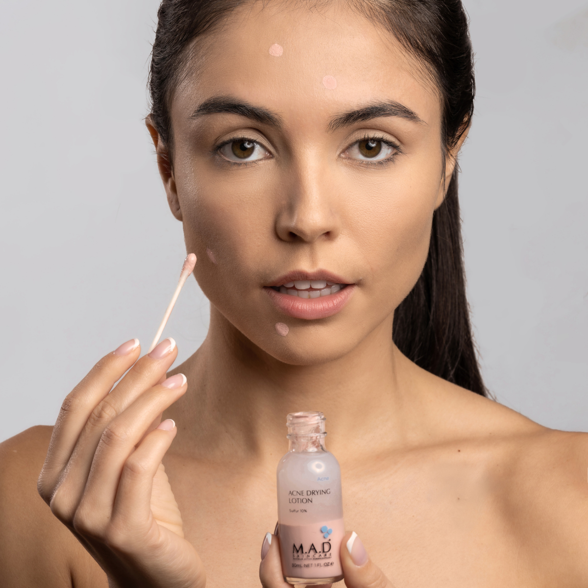 ACNE DRYING LOTION SULFUR 10%